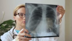 В Томской области снизился уровень заболеваемости туберкулезом